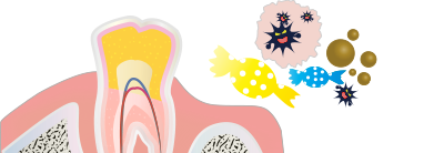 飴と歯とプラークのイラスト