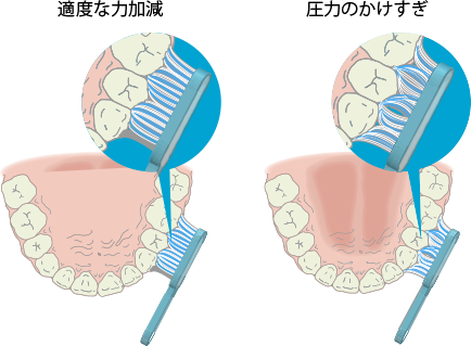 適度な力加減で歯面に毛先をきちんと当てる イラスト
