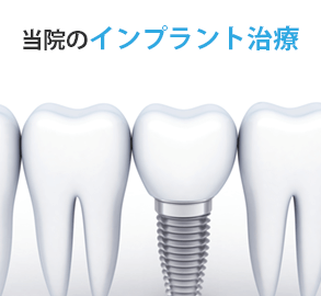 当院のインプラント治療について